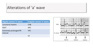 Alterations of ‘a’ wave
Regular cannon ‘a’ waves Irregular cannon ‘a’ waves
Junctional rhythm CHB
PSVT APC
Extremely prolonged PR
interval
VPC
VT
 