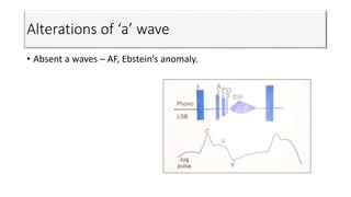 Alterations of ‘a’ wave
• Absent a waves – AF, Ebstein’s anomaly.
 