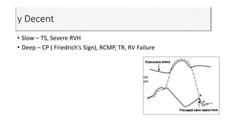 y Decent
• Slow – TS, Severe RVH
• Deep – CP ( Friedrich’s Sign), RCMP, TR, RV Failure
 