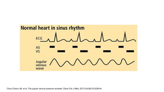 Chua Chiaco JM, et al. The jugular venous pressure revisited. Cleve Clin J Med. 2013 Oct;80(10):638-44.
 