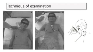 Technique of examination
 