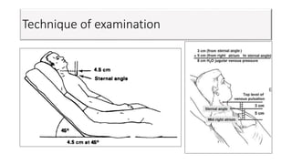 Technique of examination
 