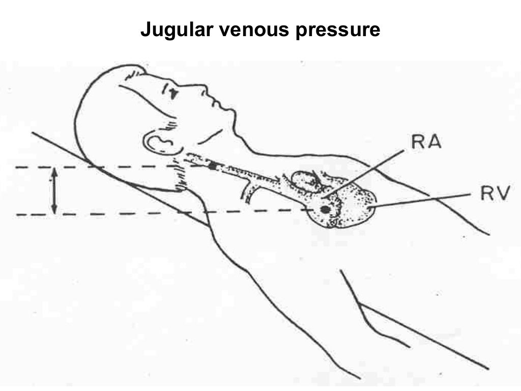Jugular Venous Pressure (JVP) Jugular Venous Pulse