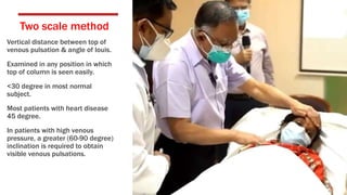 Two scale method
Vertical distance between top of
venous pulsation & angle of louis.
Examined in any position in which
top of column is seen easily.
<30 degree in most normal
subject.
Most patients with heart disease
45 degree.
In patients with high venous
pressure, a greater (60-90 degree)
inclination is required to obtain
visible venous pulsations.
 
