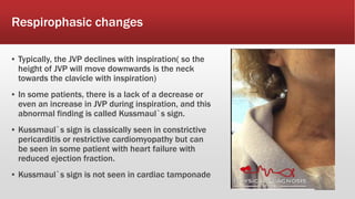 Respirophasic changes
▪ Typically, the JVP declines with inspiration( so the
height of JVP will move downwards is the neck
towards the clavicle with inspiration)
▪ In some patients, there is a lack of a decrease or
even an increase in JVP during inspiration, and this
abnormal finding is called Kussmaul`s sign.
▪ Kussmaul`s sign is classically seen in constrictive
pericarditis or restrictive cardiomyopathy but can
be seen in some patient with heart failure with
reduced ejection fraction.
▪ Kussmaul`s sign is not seen in cardiac tamponade
 