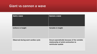 Giant vs cannon a wave
Gaint a wave Cannon a wave
Uniform in height Variable in height
Observed during each cardiac cycle Occurs sporadically because of the variable
relationship of atrial contraction to
ventricular systole
 