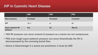 JVP in Cyanotic Heart Disease
▪ VSD RV pressure can never exceed LV pressure so a waves are not conspicuous.
▪ PDA even tough supra systemic pressure can occur theoretically the RV is
decompressed by the reversing ductal flow.
▪ Hence in Eisenmenger if a waves are prominent, it must be ASD
ASD VSD PDA
Mean pressure Increased Increased Increased
JVP a+ + a- a+
Supra systemic RV
pressure
Yes No May be
 