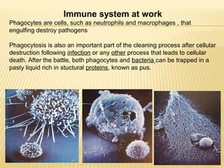 Immune system at work
Phagocytes are cells, such as neutrophils and macrophages , that
engulfing destroy pathogens
Phagocytosis is also an important part of the cleaning process after cellular
destruction following infection or any other process that leads to cellular
death. After the battle, both phagocytes and bacteria can be trapped in a
pasty liquid rich in stuctural proteins, known as pus.
 