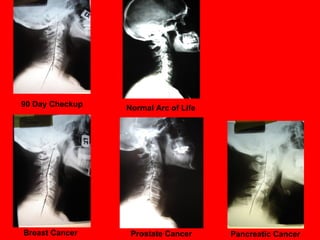 Breast Cancer Prostate Cancer Pancreatic Cancer
Normal Arc of Life90 Day Checkup
 