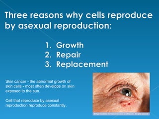 Skin cancer - the abnormal growth of
skin cells - most often develops on skin
exposed to the sun.

Cell that reproduce by asexual
reproduction reproduce constantly.
 