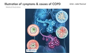 Juliet percival medical & scientific illustrator, uk | PDF