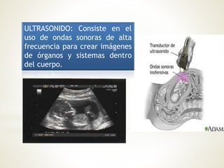 ULTRASONIDO: Consiste en el
uso de ondas sonoras de alta
frecuencia para crear imágenes
de órganos y sistemas dentro
del cuerpo.
 