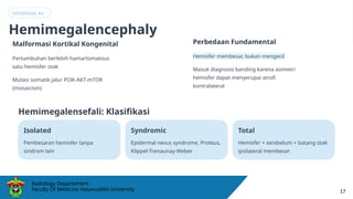 Hemi Rip Mix Comprehensive Pediatric Cerebral Hemiatrophy: Diagnosis and ...