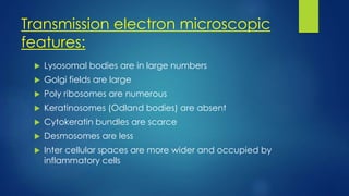 Transmission electron microscopic
features:
 Lysosomal bodies are in large numbers
 Golgi fields are large
 Poly ribosomes are numerous
 Keratinosomes (Odland bodies) are absent
 Cytokeratin bundles are scarce
 Desmosomes are less
 Inter cellular spaces are more wider and occupied by
inflammatory cells
 