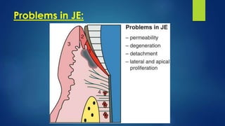 Problems in JE:
 
