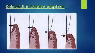 Role of JE in passive eruption:
 