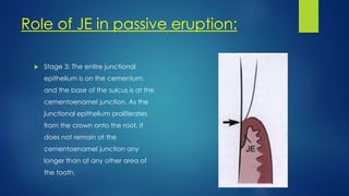 Role of JE in passive eruption:
 Stage 3: The entire junctional
epithelium is on the cementum,
and the base of the sulcus is at the
cementoenamel junction. As the
junctional epithelium proliferates
from the crown onto the root, it
does not remain at the
cementoenamel junction any
longer than at any other area of
the tooth.
 