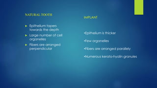 NATURAL TOOTH
 Epithelium tapers
towards the depth
 Large number of cell
organelles
 Fibers are arranged
perpendicular
IMPLANT
•Epithelium is thicker
•Few organelles
•Fibers are arranged parallely
•Numerous kerato-hyalin granules
 