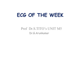 ECG OF THE WEEK Prof  Dr.S.TITO’s UNIT M5  Dr.G.Arunkumar 