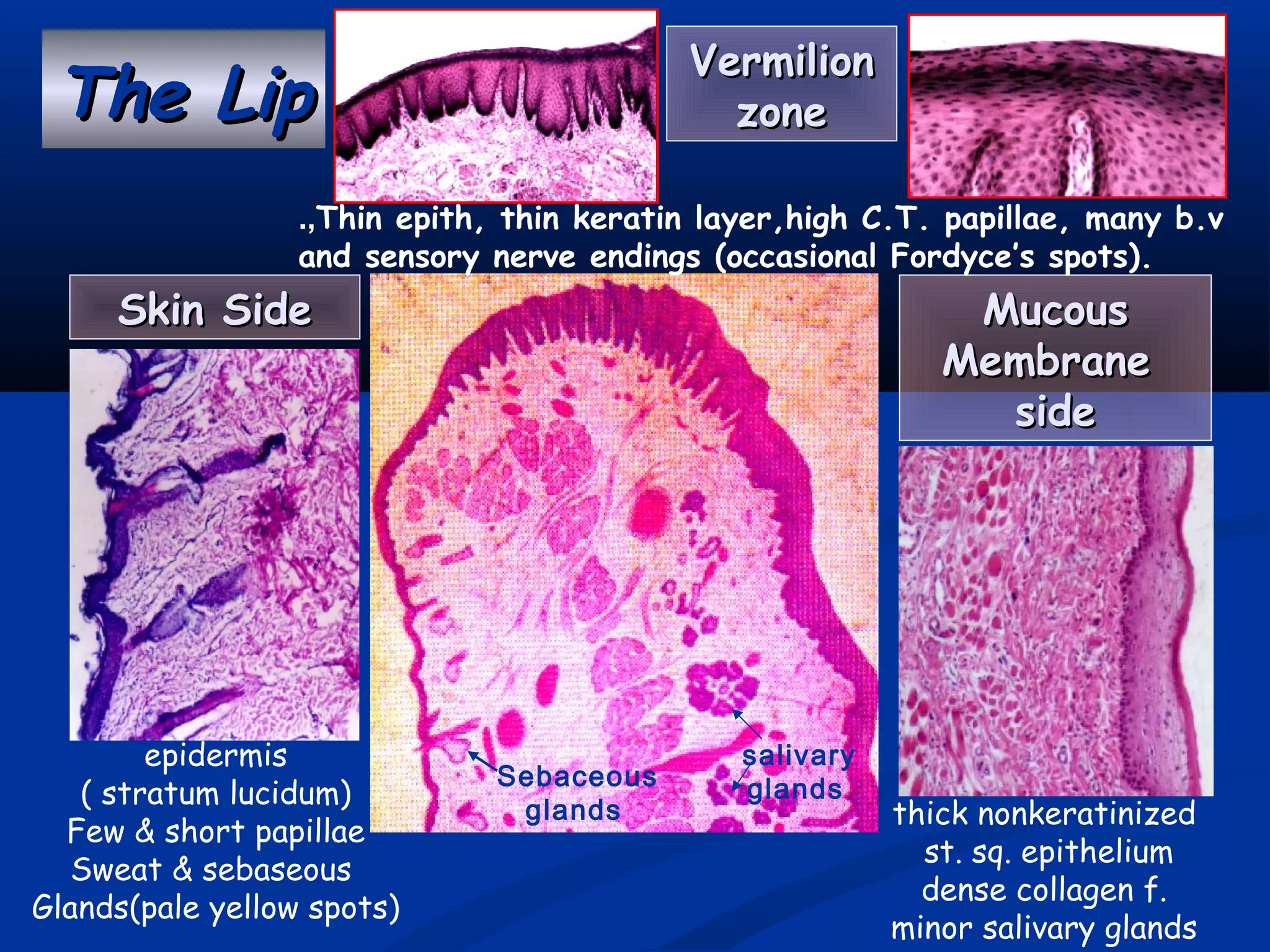 The LipThe Lip
Skin SideSkin Side
VermilionVermilion
zonezone
MucousMucous
MembraneMembrane
sideside
Sebaceous
glands
salivary
glands
epidermis
( stratum lucidum)
Few & short papillae
Sweat & sebaseous
Glands(pale yellow spots)
thick nonkeratinized
st. sq. epithelium
dense collagen f.
minor salivary glands
Thin epith, thin keratin layer,high C.T. papillae, many b.v.,
and sensory nerve endings (occasional Fordyce’s spots).
 