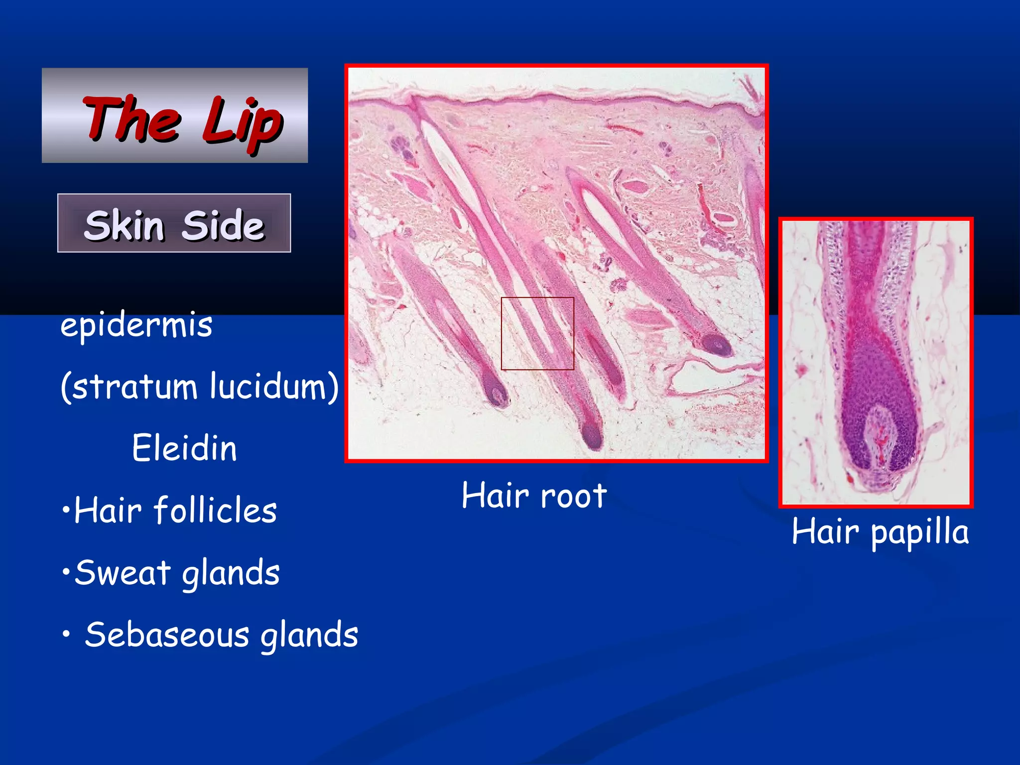 The LipThe Lip
Skin SideSkin Side
epidermis
(stratum lucidum)
Eleidin
•Hair follicles
•Sweat glands
• Sebaseous glands
Hair papilla
Hair root
 