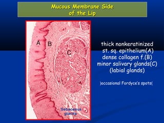 Mucous Membrane SideMucous Membrane Side
of the Lipof the Lip
thick nonkeratinized
st. sq. epithelium(A)
dense collagen f.(B)
minor salivary glands(C)
(labial glands)
Sebaceous
glands
)occasional Fordyce’s spots(
 