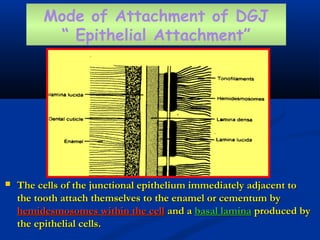  The cells of the junctional epithelium immediately adjacent toThe cells of the junctional epithelium immediately adjacent to
the tooth attach themselves to the enamel or cementum bythe tooth attach themselves to the enamel or cementum by
hemidesmosomes within the cellhemidesmosomes within the cell and aand a basal laminabasal lamina produced byproduced by
the epithelial cells.the epithelial cells.
Mode of Attachment of DGJ
“ Epithelial Attachment”
 