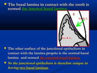  The basal lamina in contact with the tooth isThe basal lamina in contact with the tooth is
termedtermed the internal basal lamina.the internal basal lamina.
 The other surface of the junctional epithelium inThe other surface of the junctional epithelium in
contact with the lamina propria is the normal basalcontact with the lamina propria is the normal basal
laminalamina and termedand termed the external basal lamina.the external basal lamina.
 So the junctional epithelium is therefore unique inSo the junctional epithelium is therefore unique in
havinghaving two basal laminaetwo basal laminae..
Int. B. L.
Ext. B. L.
E
 