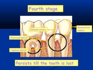 Fourth stage
Anatomical
crownClinical crown
Coronal end (C(
Apical end (C(`
Persists till the tooth is lost
 