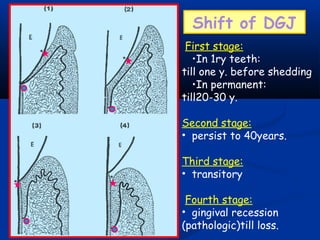 Shift of DGJ
First stage:
•In 1ry teeth:
till one y. before shedding
•In permanent:
till20-30 y.
Second stage:
• persist to 40years.
Third stage:
• transitory
Fourth stage:
• gingival recession
(pathologic)till loss.
 