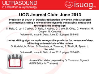 UOG Journal Club: June 2013
Prediction of pouch of Douglas obliteration in women with suspected
endometriosis using a new real-time dynamic transvaginal ultrasound
technique: the sliding sign
S. Reid, C. Lu, I. Casikar, G. Reid, J. Abbott, G. Cario, D. Chou, D. Kowalski, M.
Cooper, G. Condous
Volume 41, Issue 6, Date: June 2013, pages 685–691
Uterine sliding sign: a simple sonographic predictor for presence of deep
infiltrating endometriosis of the rectum
G. Hudelist, N. Fritzer, S. Staettner, A. Tammaa, A. Tinelli, R. Sparic, J.
Keckstein
Volume 41, Issue 6, Date: June 2013, pages 692–695
Journal Club slides prepared by Dr Tommaso Bignardi
(UOG Editor for Trainees)
 