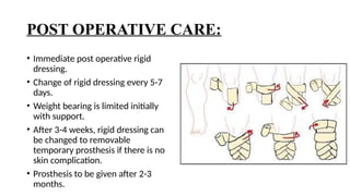 Emovable Rigid Dressing juned ppy.pptx amputation of lower limb and explanation | PPTX