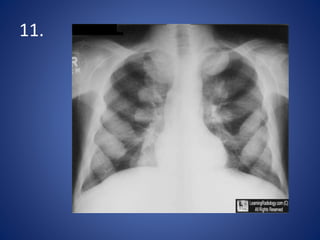 Radiology spotters | PPTX