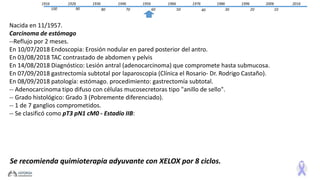 1916 2006
1020
19961986
3040
19761966
5060
19561946
7080
19361926
90100
2016
Nacida en 11/1957.
Carcinoma de estómago
--Reflujo por 2 meses.
En 10/07/2018 Endoscopia: Erosión nodular en pared posterior del antro.
En 03/08/2018 TAC contrastado de abdomen y pelvis
En 14/08/2018 Diagnóstico: Lesión antral (adenocarcinoma) que compromete hasta submucosa.
En 07/09/2018 gastrectomía subtotal por laparoscopia (Clínica el Rosario- Dr. Rodrigo Castaño).
En 08/09/2018 patología: estómago. procedimiento: gastrectomía subtotal.
-- Adenocarcinoma tipo difuso con células mucosecretoras tipo "anillo de sello".
-- Grado histológico: Grado 3 (Pobremente diferenciado).
-- 1 de 7 ganglios comprometidos.
-- Se clasificó como pT3 pN1 cM0 - Estadío IIB:
Se recomienda quimioterapia adyuvante con XELOX por 8 ciclos.
 