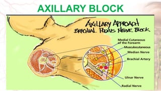Anatomy of Brachial plexus | PPTX