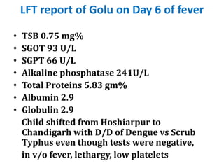 LFT report of Golu on Day 6 of fever
• TSB 0.75 mg%
• SGOT 93 U/L
• SGPT 66 U/L
• Alkaline phosphatase 241U/L
• Total Proteins 5.83 gm%
• Albumin 2.9
• Globulin 2.9
Child shifted from Hoshiarpur to
Chandigarh with D/D of Dengue vs Scrub
Typhus even though tests were negative,
in v/o fever, lethargy, low platelets
 