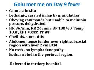 Golu met me on Day 9 fever
• Cannula in situ
• Lethargic, carried in lap by grandfather
• Obeying commands but unable to maintain
posture, dehydrated
• HR 86/min, RR 26/min, BP 100/60 Temp
103F, CFT =3sec, PPWF
• Cheilitis, stomatitis
• Abdomen tense tender over right subcostal
region with liver 2 cm BCM
• No rash , no lymphadenopathy
Eschar noted in the perineal region.
Referred to tertiary hospital.
 