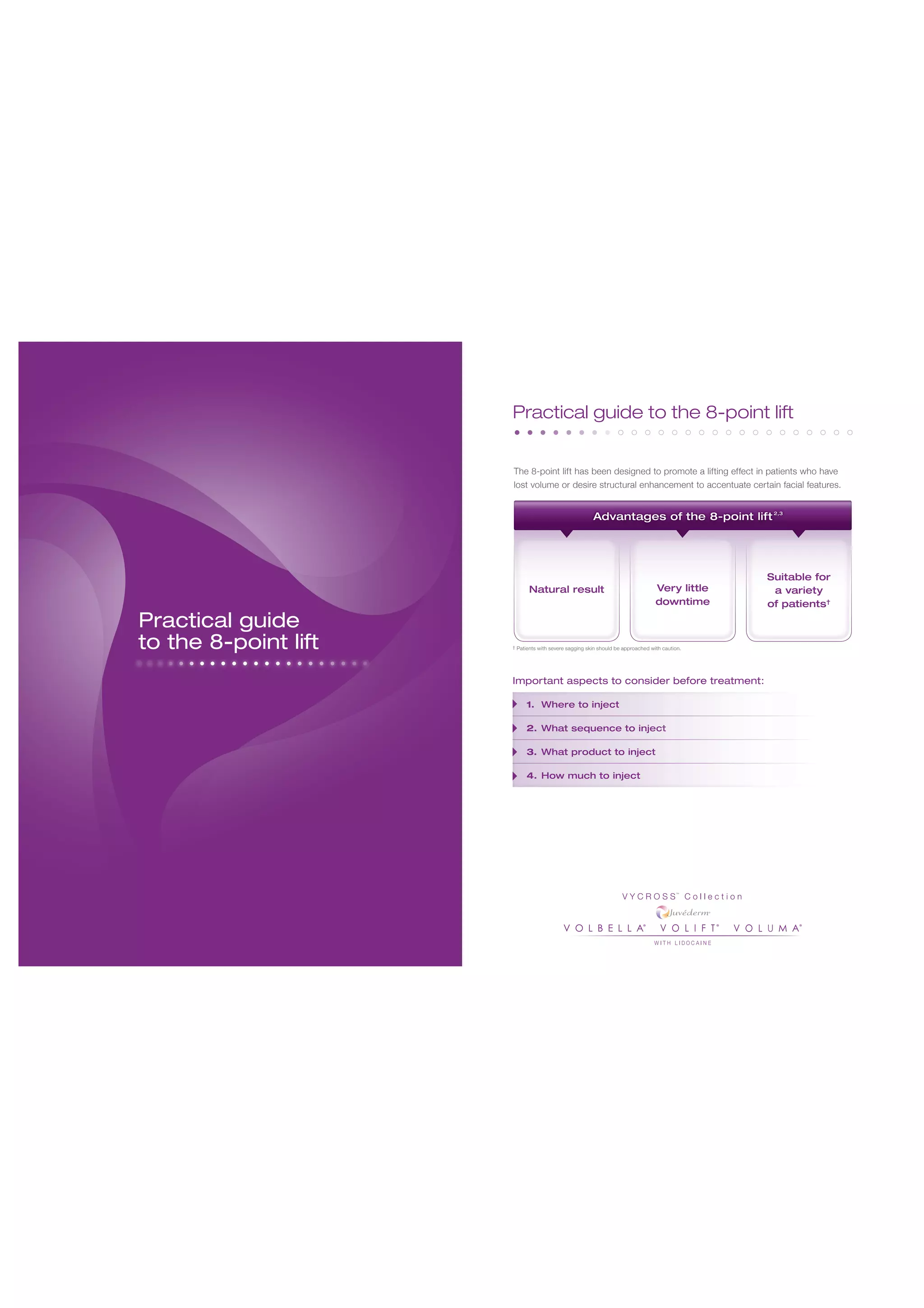 Juvederm brochure 8 points lift | PDF