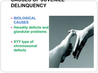 CAUSES OF JUVENILE
DELINQUENCY
 BIOLOGICAL
CAUSES
 Heredity defects and
glandular problems
 XYY type of
chromosomal
defects
 