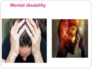 Mental disability
 