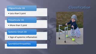 Poly Jia Juvenile idiopathic arthritis | PPTX