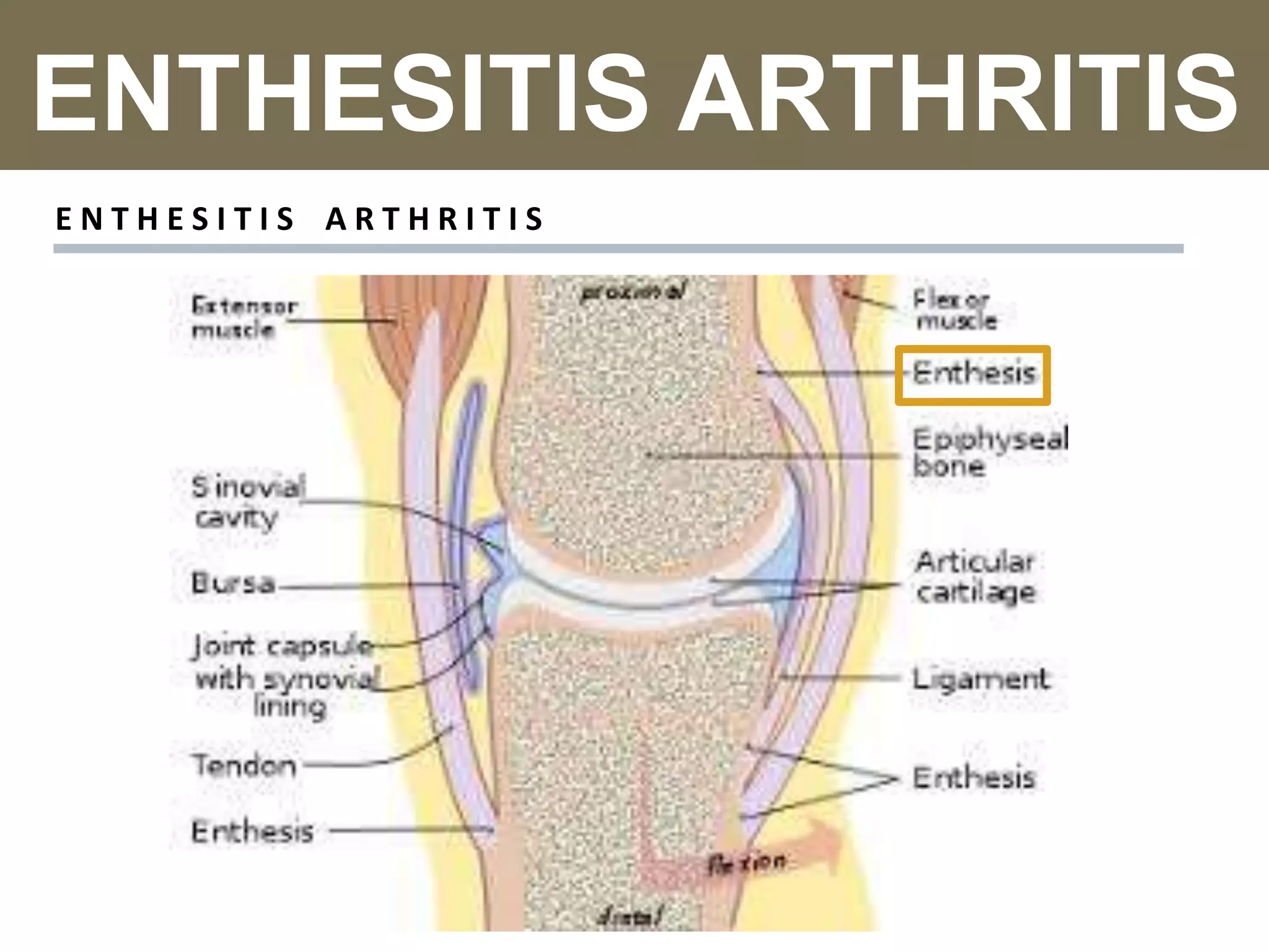 Juvenile Idiopathic Arthritis JIA PPTX juvenile-idiopathic-arthritis-jia-pptx
