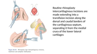Transfixion Incision Rhinoplasty Comprehensive Overview of Juvenile Nasopharyngeal Angiofibroma ...