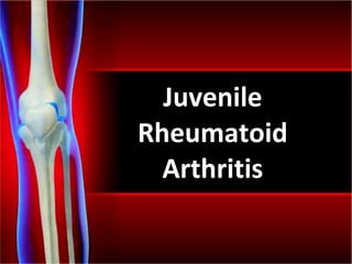 Juvenile Rheumatoid Arthritis 