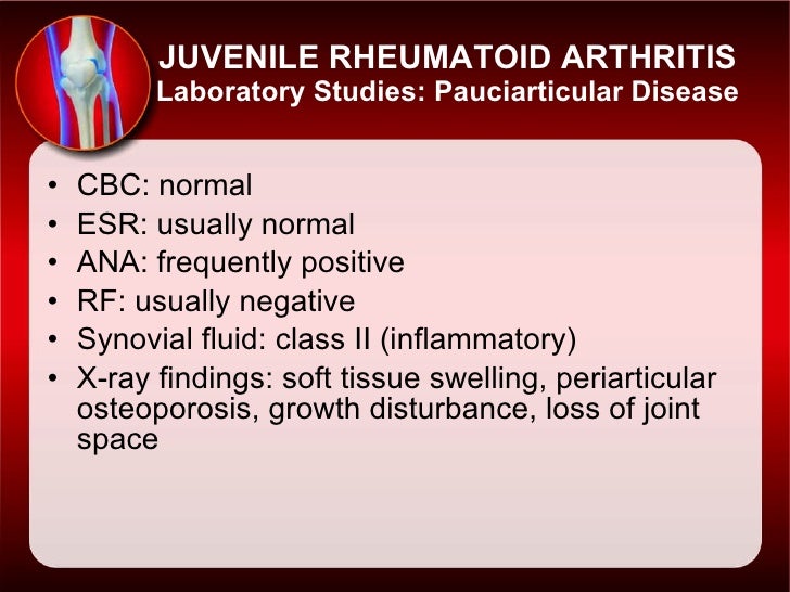 Juvenile+Rheumatoid+Arthritis+slides+