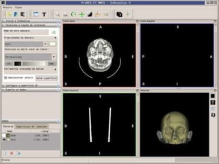 Ajudar a desenvolver, proteger e padronizar o Linux. 