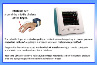 The menagerie of monitoring tools by Professor Jean-Louis Teboul | PPTX