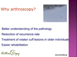 www.shoulder.grwww.shoulder.gr
Better understanding of the pathology
Reduction of recurrence rate
Treatment of rotator cuff lesions in older individuals
Easier rehabilitation
Why arthroscopy?
 