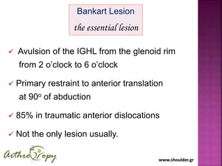 www.shoulder.grwww.shoulder.gr
Bankart Lesion
the essential lesion
 Avulsion of the IGHL from the glenoid rim
from 2 o’clock to 6 o’clock
 Primary restraint to anterior translation
at 90o of abduction
 85% in traumatic anterior dislocations
 Not the only lesion usually.
 