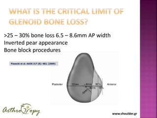 www.shoulder.gr
>25 – 30% bone loss 6.5 – 8.6mm AP width
Inverted pear appearance
Bone block procedures
Piasecki et al. AAOS J17 (8): 482. (2009)
 